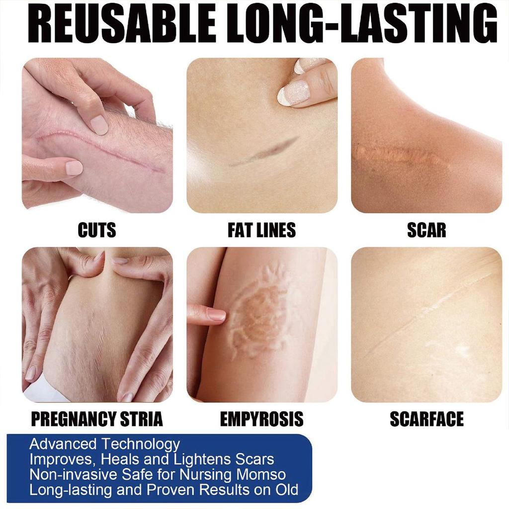 The Repair Cream Is Gentle and Non-irritating, Lightens Scars, Fades Fine Lines, and Leaves Skin Soft and Refined