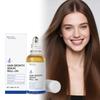 Serum na porost włosów Roll-On 30ml Na przerzedzające się włosy i wszystkie typy włosów Odżywiające skórę głowy Wspomagające porost włosów Serum Olejek Roll-on Serum Olejek, 30ml