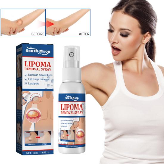 Yousheng 50ml Fatty Lump Spray Skin Care Safe Body Lipoma Removal Liquid Spray for Unisex
