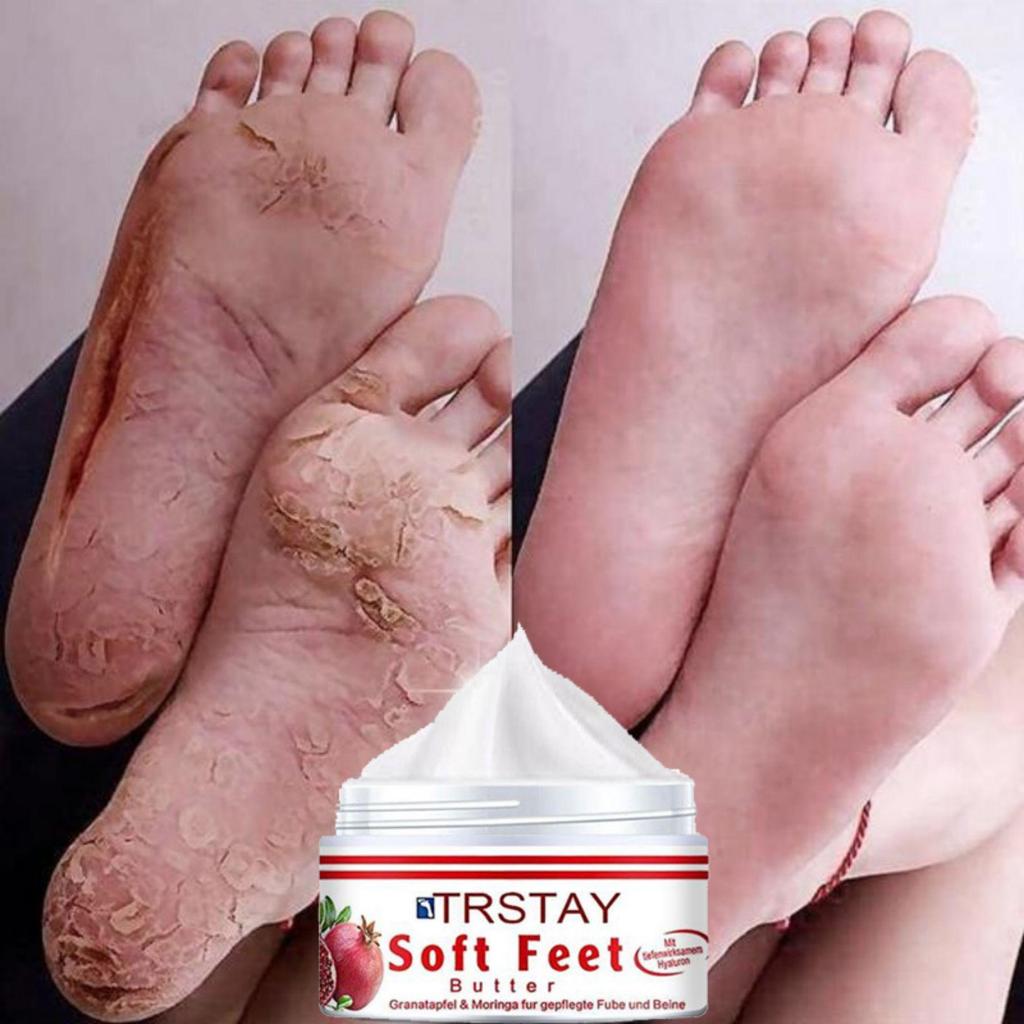Cracked Repair Remove Callus Dead Skin Care Anti-dry Mask Exfoliating Socks Feet Care Foot Treatment