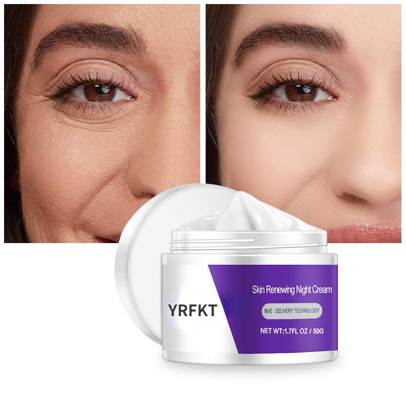 Dark Spot Removal Whitening Skin Cream Remove Melasma Acne Spot Pigment Melanin Dark Spot Pigmentation Moisturizing Gel