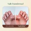 MOHA Nail Care Cream For Stronger Nails And Soft Cuticles, Daily Nourishing Nail Strengthener 100 G Pack Of 1 Use