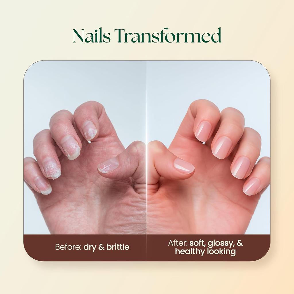 Moha Nail Care Cream For Stronger Nails And Soft Cuticles, Daily Nail Strengthener For Men Women 100 g x Pack Of 2