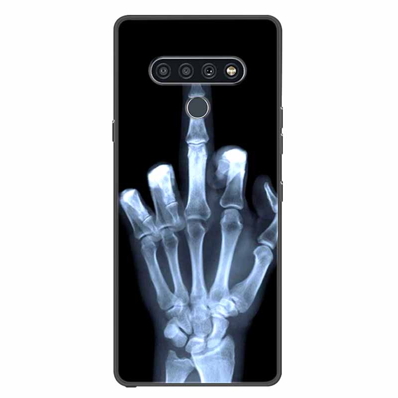 For LG K41s K51s Case Silicone Soft Fashion Animal Back Cover for LG Q70 Q60 Case Protector On for LGQ60 K 51S Cartoon Phone Bag
