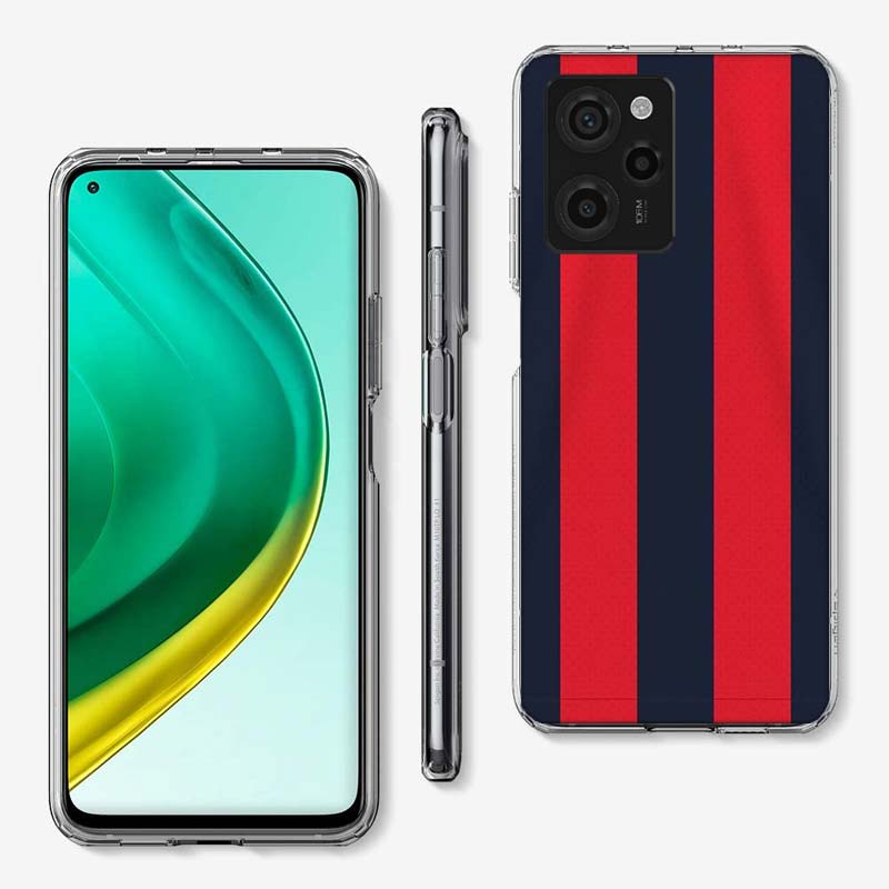 Milan Stylish Stripe Design Phone Case For Redmi 12 13C 12C 15C 15 9 Power 10 Prime+ 10C 10A 9T 9C 9i 9AT 9A Sport A5 K50 K30 60
