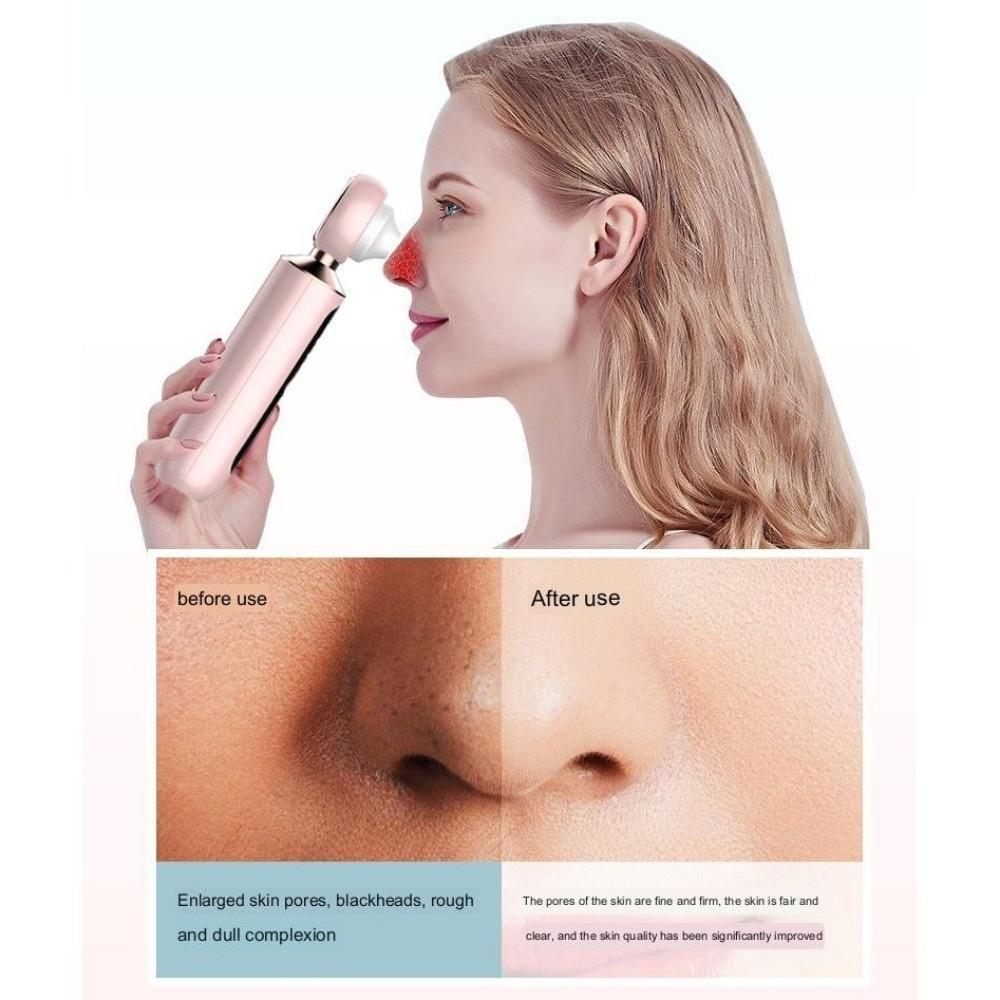 Visual Electric Blackhead Remover Pore Cleanser Blackhead Sucker  Home