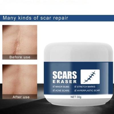 Not Irritating Repair Damage Synthetic Scar Remove Cream