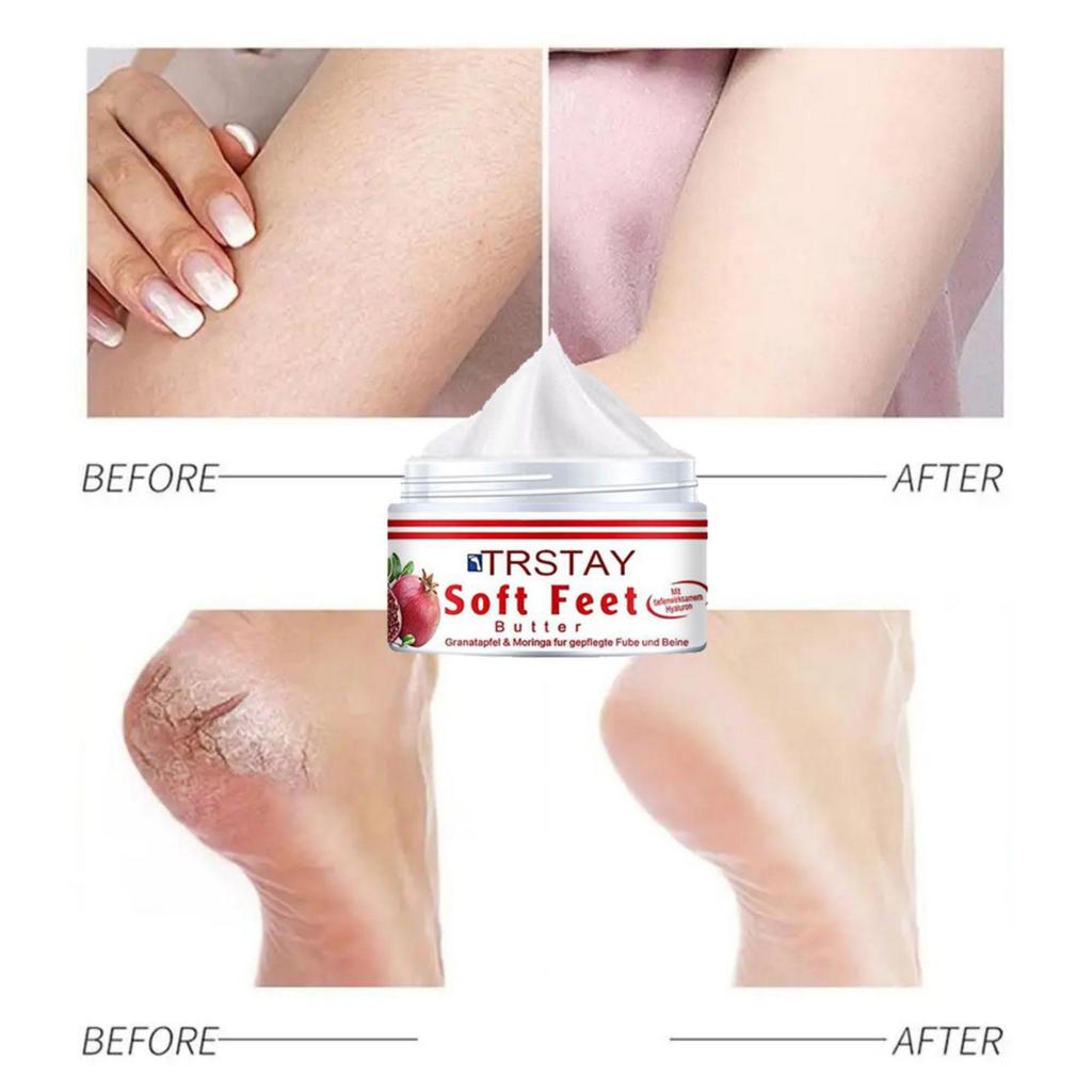Cracked Repair Remove Callus Dead Skin Care Anti-dry Mask Exfoliating Socks Feet Care Foot Treatment
