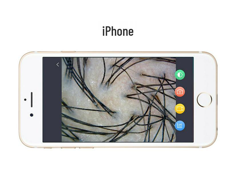 JHOT Wireless Hair & Scalp Analyzer – Hair Follicle Tester for Growth Clinics