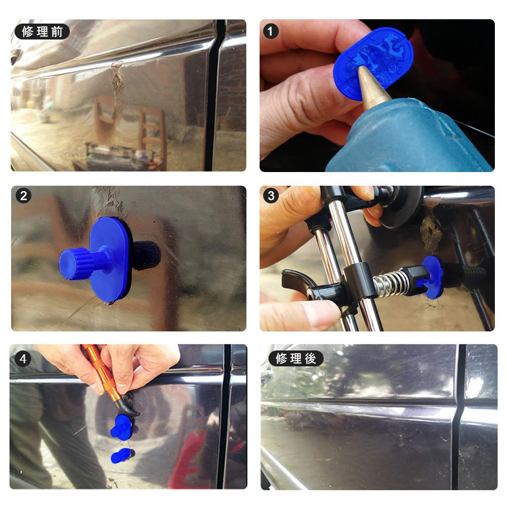 Gliston Dent Repair Pulling Vacuum DIY Supplies Tool, Bridge-type Tool, Lifter,