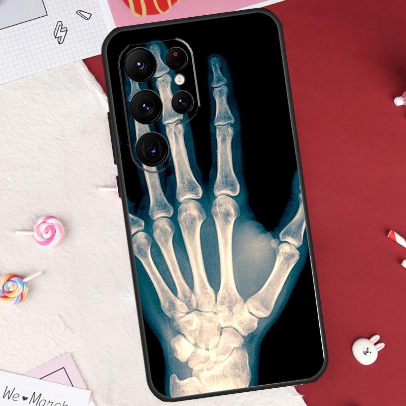

Рентгеновский чехол с анатомией человека для Samsung Galaxy S26 Ultra S20 S21 S22 S23 S24 S25 Ultra S10 Plus S25 FE Защитный корпус Galaxy S22 Plus