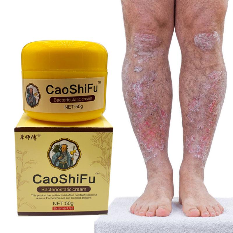 Skin Care Ointment Anti Itch Anti Bacterial, Natural Ointment Relieves Various Skin Problems 50g