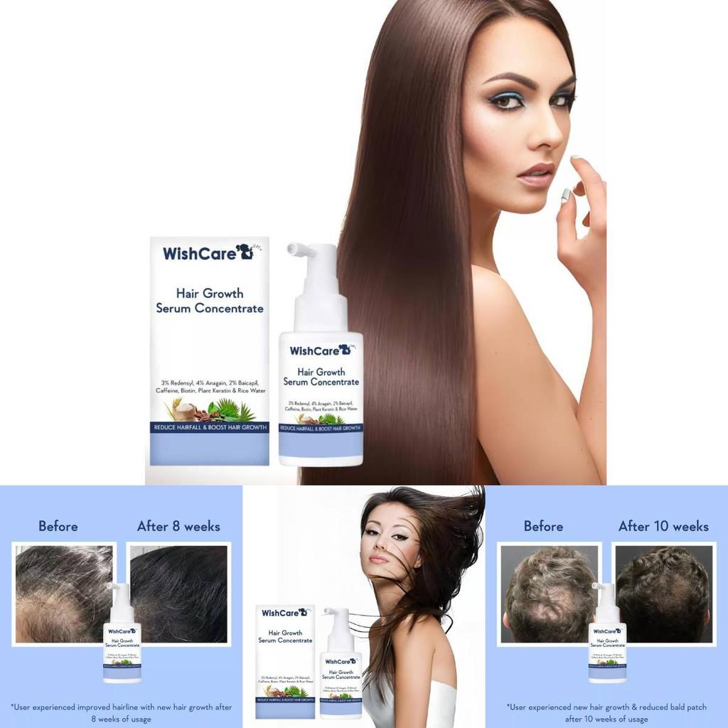 B3014 Hair Growth Concentrate Serum For Home Use With Luxurious Packaging For All Hair Types