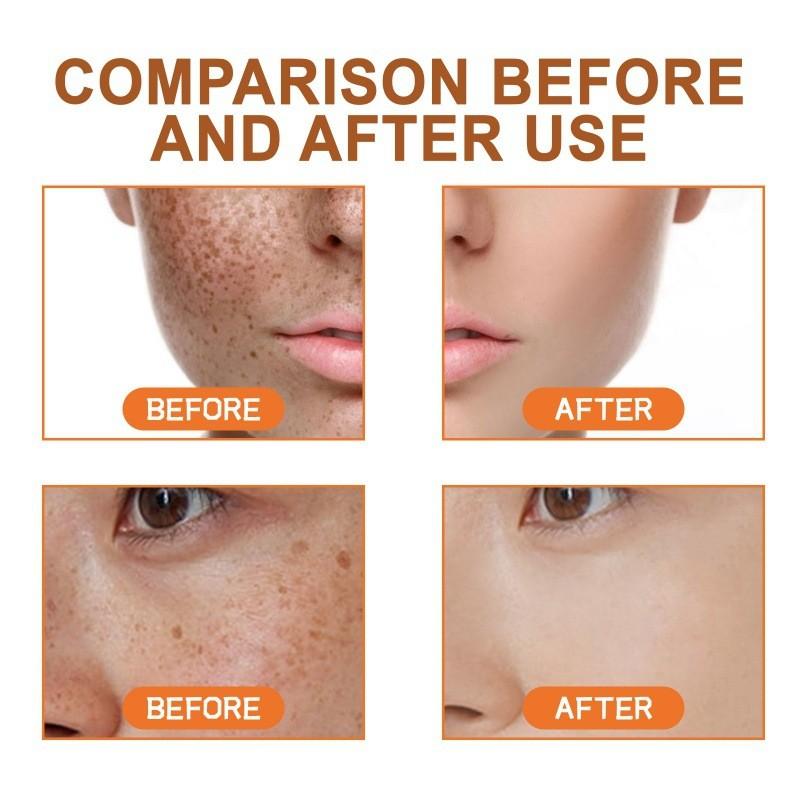 West Month Caffeine Facial Serum For Brightening Dull Skin Minimizing Pores And Hydrating