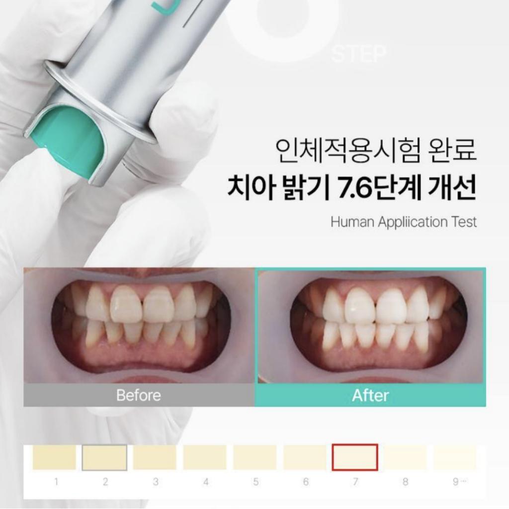 [LiveOrals] Pure Dia Self Teeth Whitener (2week Supply)