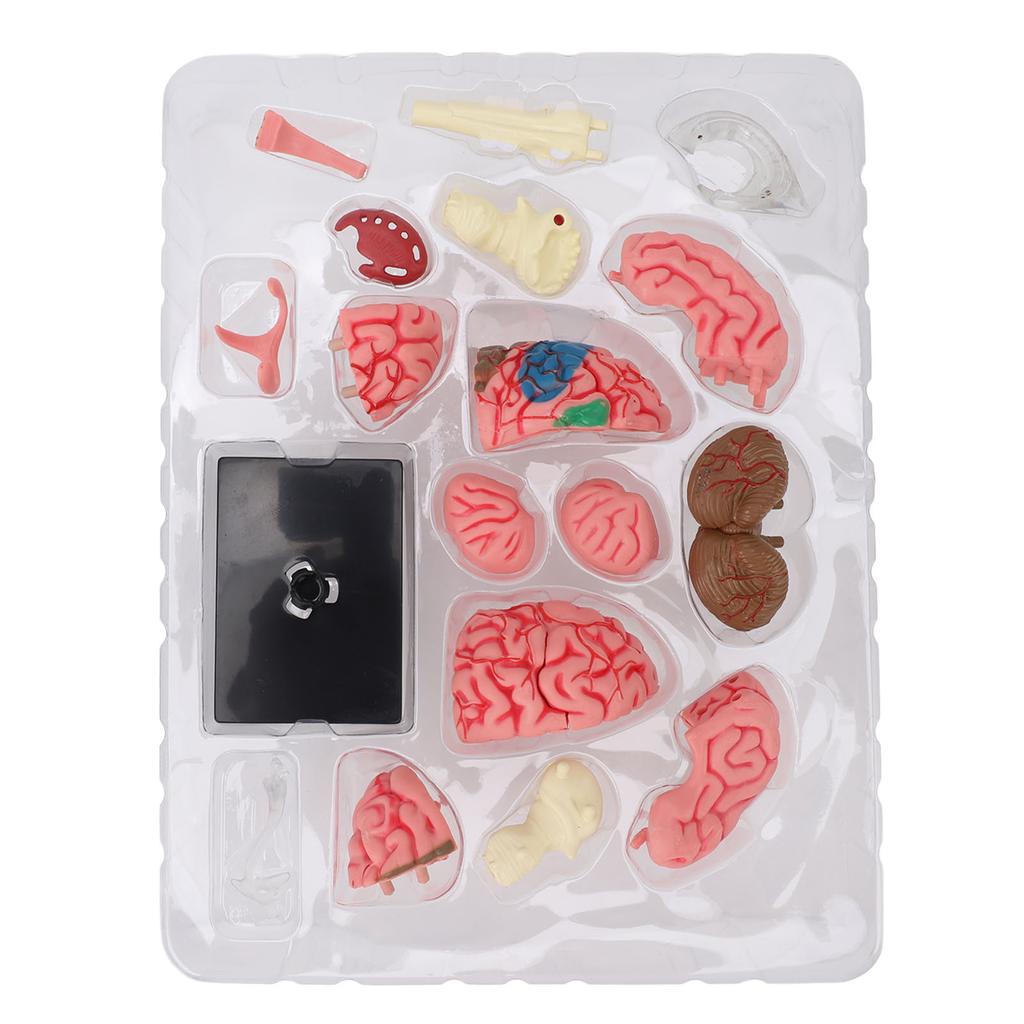 Gehirnmodell Neuroanatomie Struktur Lehrmittel Menschliches Gehirn Anatomisches Modell mit Basis für Bildung Ausstellung
