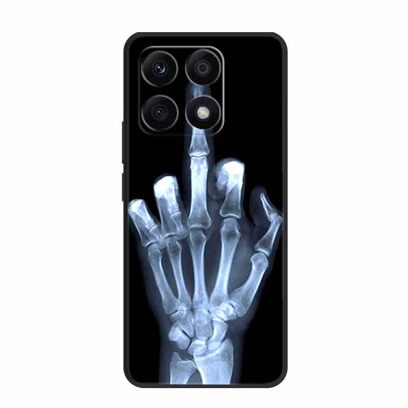 For Xiaomi 17 5G Case Flowers Butterfly Soft Silicone Phone Cases for Xiaomi 17 5G Cool Wolf Animals Protective Shockproof Shell