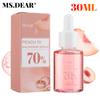 30ml Niacinamide Serum Melanin Removal Fade Melasma Dark Spots Corrector Shrink Pores Hyaluronic Acid Moisturizing Skin Care