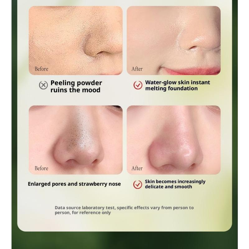 Acne Mask Sensitive Muscle Soothing Moisturizing Multi-acid Mild Oil Control Acne-removing Pore Blackhead Patch