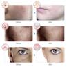 7-Color LED Beauty Mask: Home Photorejuvenation Red Light Therapy Device