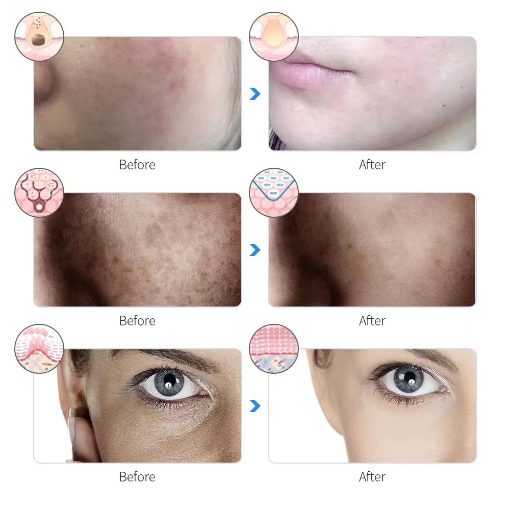 7-Color LED Beauty Mask: Home Photorejuvenation Red Light Therapy Device