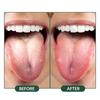 Tongue Cleaning Brush Soft Silicone Tongue Cleaning Tool Double Side Cleaning Massage Tongue Scraper Oral Health Care Tool