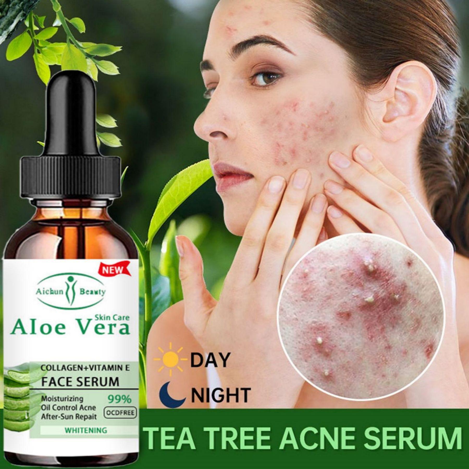 

Мгновенная молодость с нашим отбеливающим и антивозрастным кремом