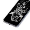 Cardiovascular Model Heart Phone Case For Xiaomi Mi Poco X6 X5 NFC X3 F6 F5 Pro F4 F3 15 14T 14 13T 12T 12 13 Lite 11 Cover