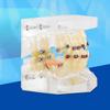 Dental Orthodontic Treatment Malocclusion Study Teeth Model With Wire Chain