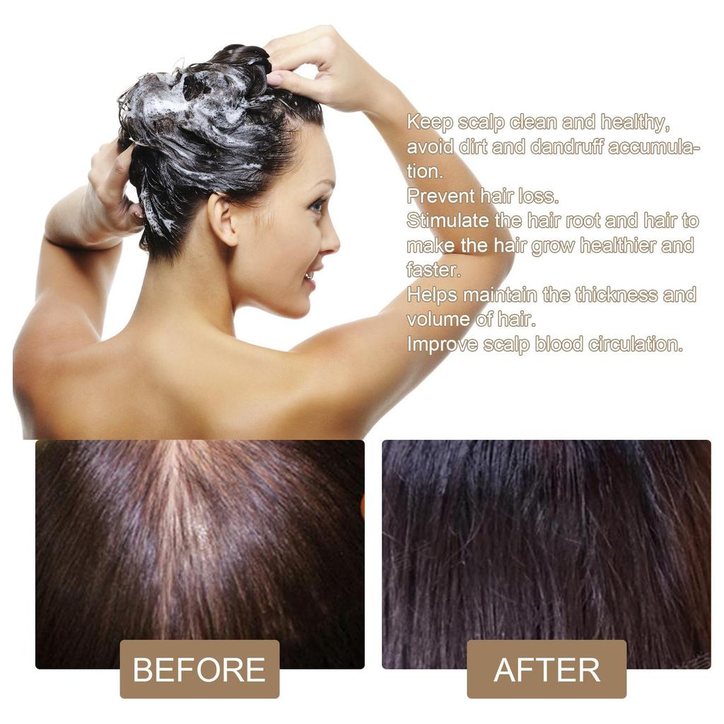 EELHOE Rice anti-hair loss shampoo soap 100g oil contro /deep cleansing/ fluffy /smooth/strong hair root/nourishing repair/anti-dandruff