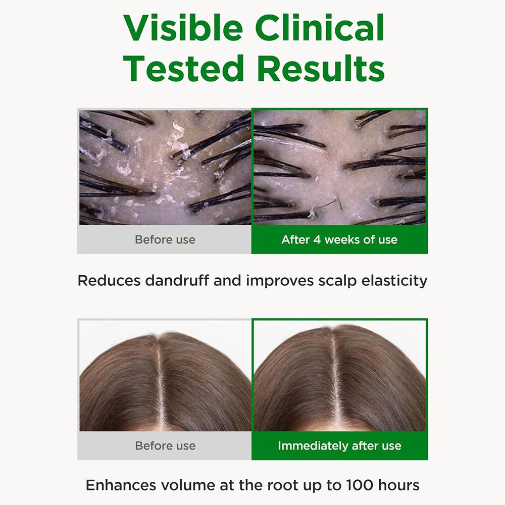 CKD Amino Biotin All-Powerful Treatment 150ml