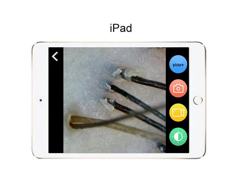 JHOT Wireless Hair & Scalp Analyzer – Hair Follicle Tester for Growth Clinics