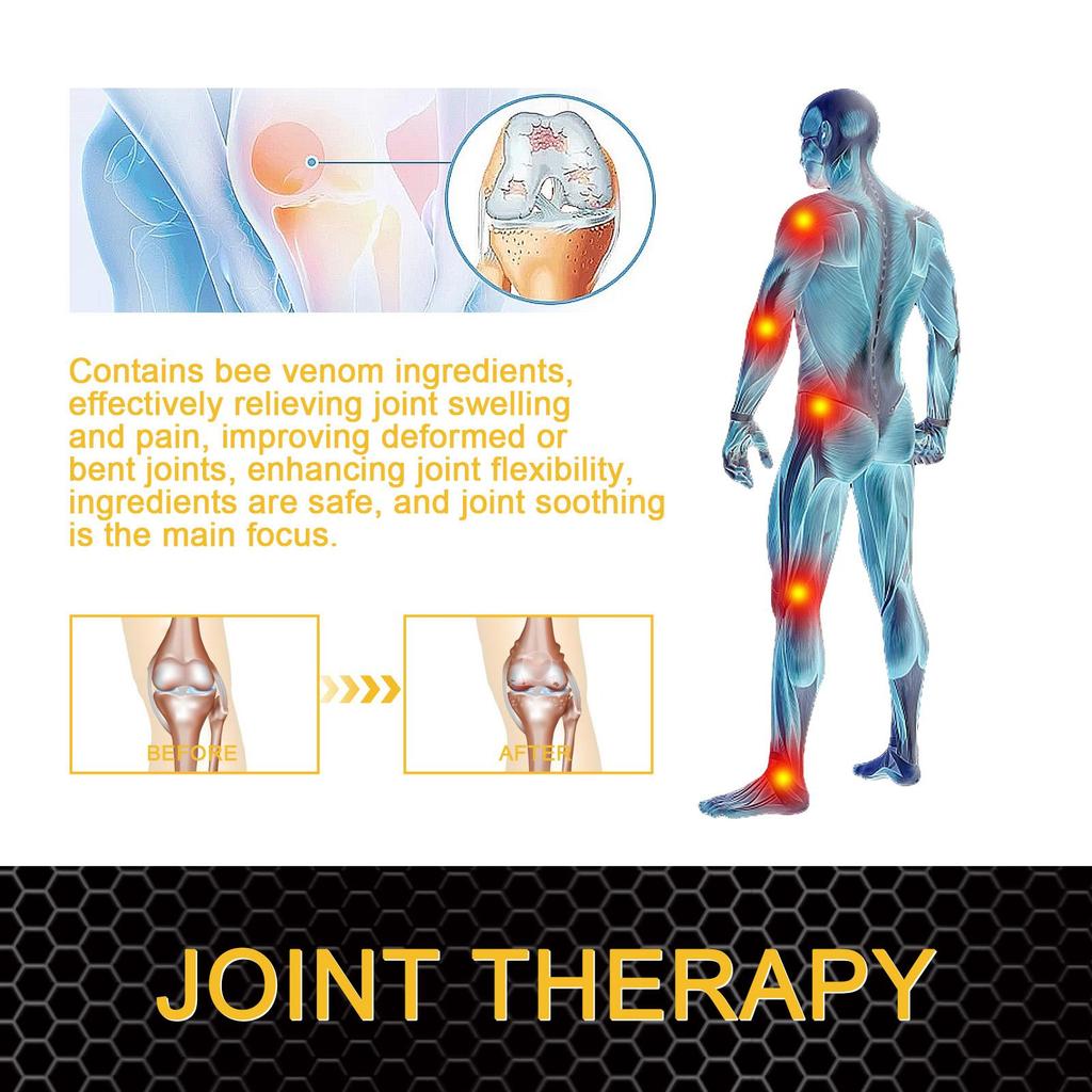 20g Bee Venom Joint Care Gel Relieves aching muscles and bones with gentle care to improve joint stiffness and discomfort.