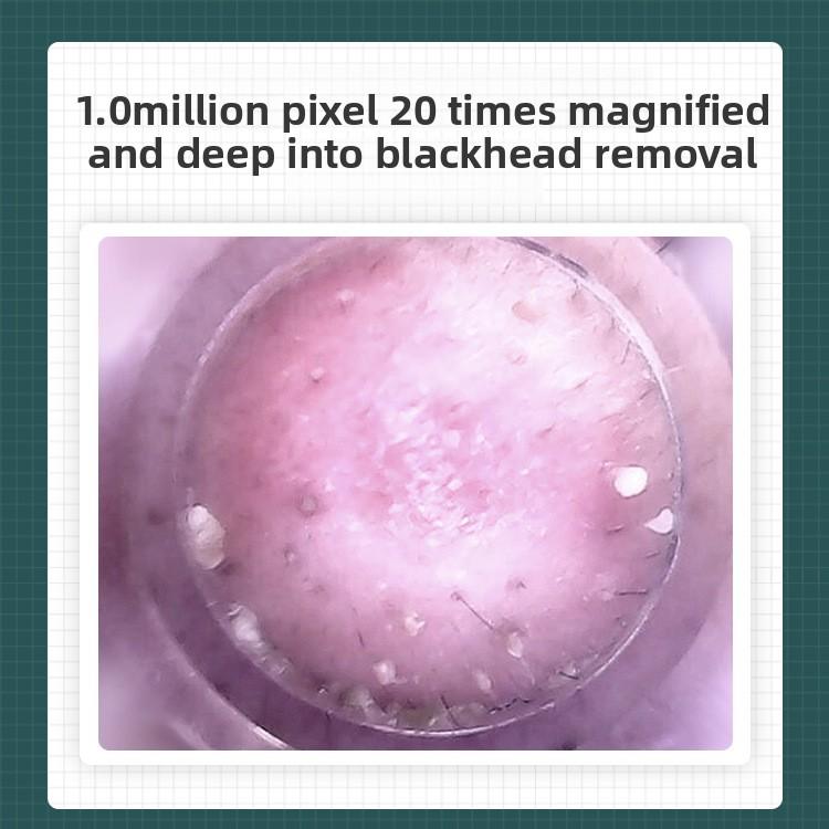 Blackhead Suction Beauty Instrument, Visual Blackhead Instrument Artifact, Electric Blackhead Suction Instrument