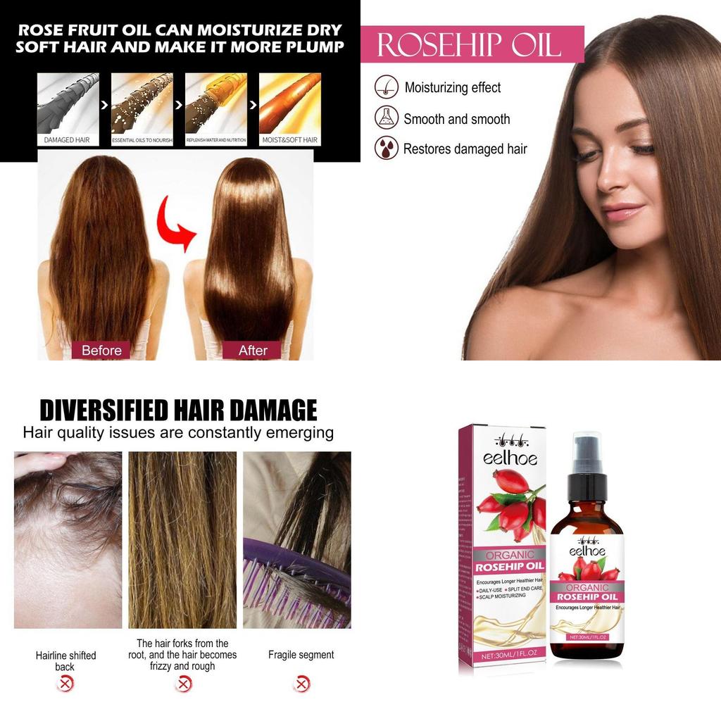 Eelhoe Nourishing Rosehip Oil For Hair Moisturizing And Strengthening 30ml Bottle