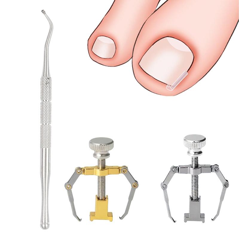 Medical Ingrown Toenail Correction Kit – Professional Nail Care Tool for Treatment and Recovery