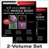 CT and MRI of the Whole Body Hardcover Ok-25