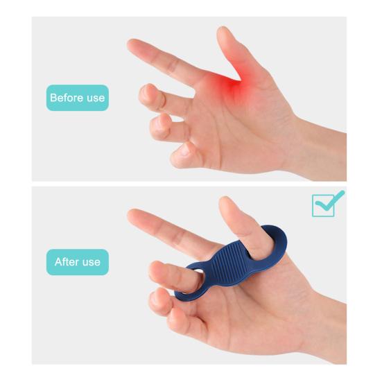 Silicone Baseball Thumb Guard Shock Absorption Batting Training Aid Swing Grip Enhancer for Baseball Softball Hand Protection