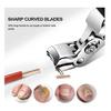Funfany Orthoclip,Zoerely Orthoclip Stainless Steel Nail Clipper,Wide-Mouth Bite
