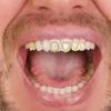 Fashionable Metal Fang Grillzs Hollow Teeth Jewelry Copper Texture Dental Accessory Suitable for Parties and Event
