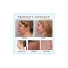 3PCS Lift Chin Mask, Chin Mask, Chin Mask Double Chin Lifting Mask, Collagen Face Mask, Chin Mask Reusable For Double Chin
