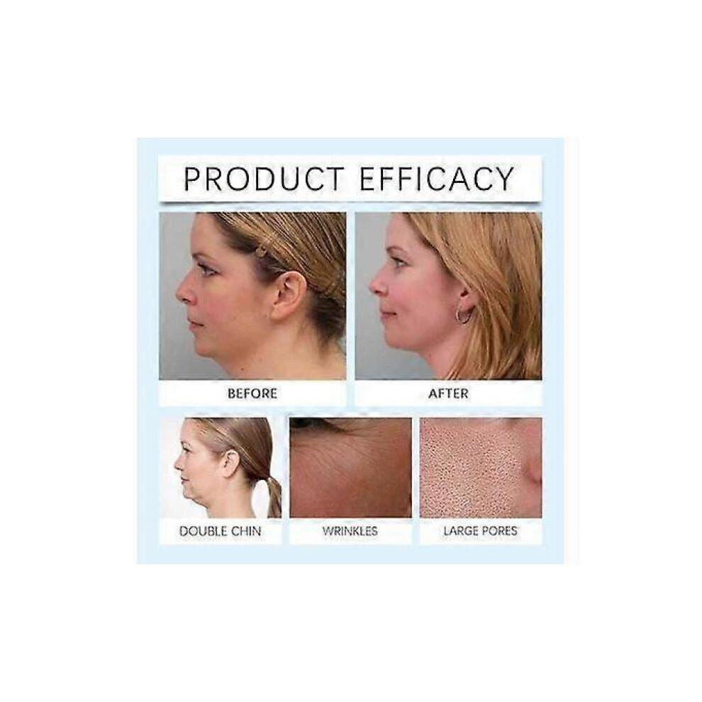 3PCS Lift Chin Mask, Chin Mask, Chin Mask Double Chin Lifting Mask, Collagen Face Mask, Chin Mask Reusable For Double Chin