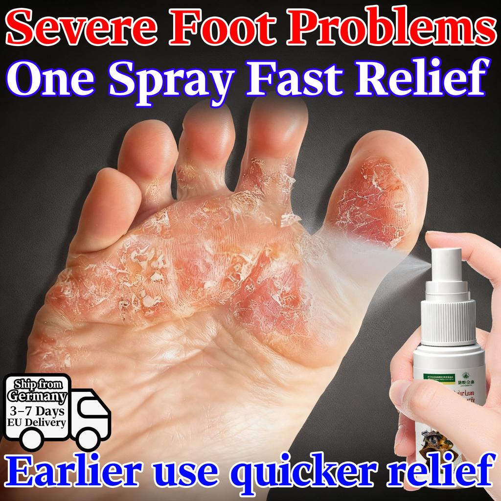 Natural Herbs Salve for Frostnip & Cracked Hands Feet - Gentle Non-Irritating