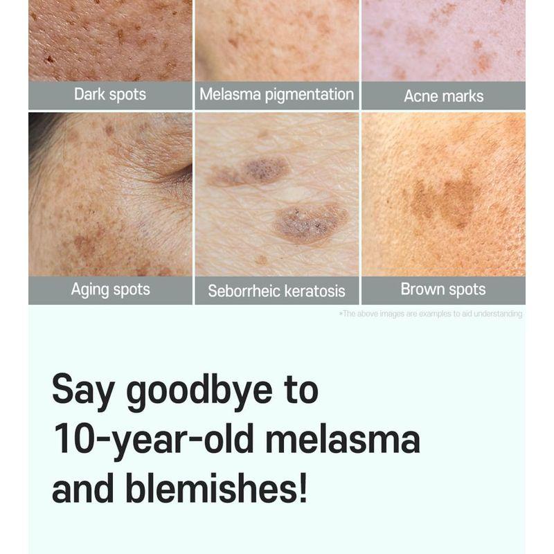 CARE:NEL - Anti-Melasma Cica Intensivserum