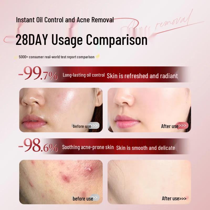 Bailingniao Salicylic Acid Acne & Mark Repair Cream