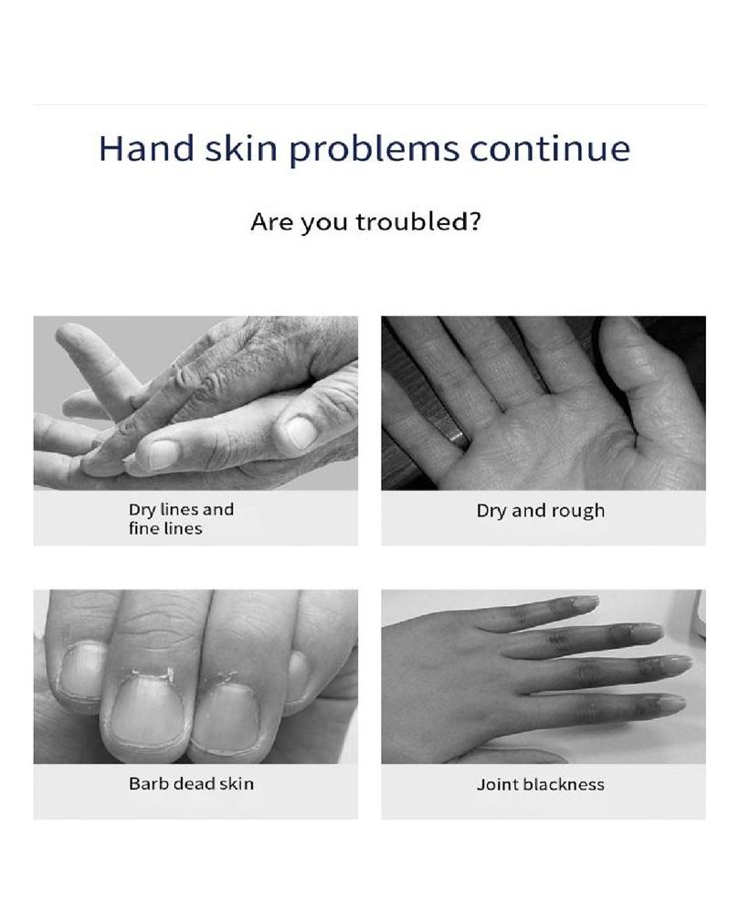 Niacinamide Soft Hand Mask Feuchtigkeitsspendende, Peeling- und Anti-Trocknungs-Handmaske. Handpflege