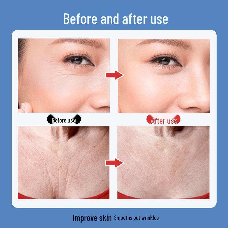 Silikon Anti-Falten Gesichts- und Augenpflaster Set zum Lifting und Straffen