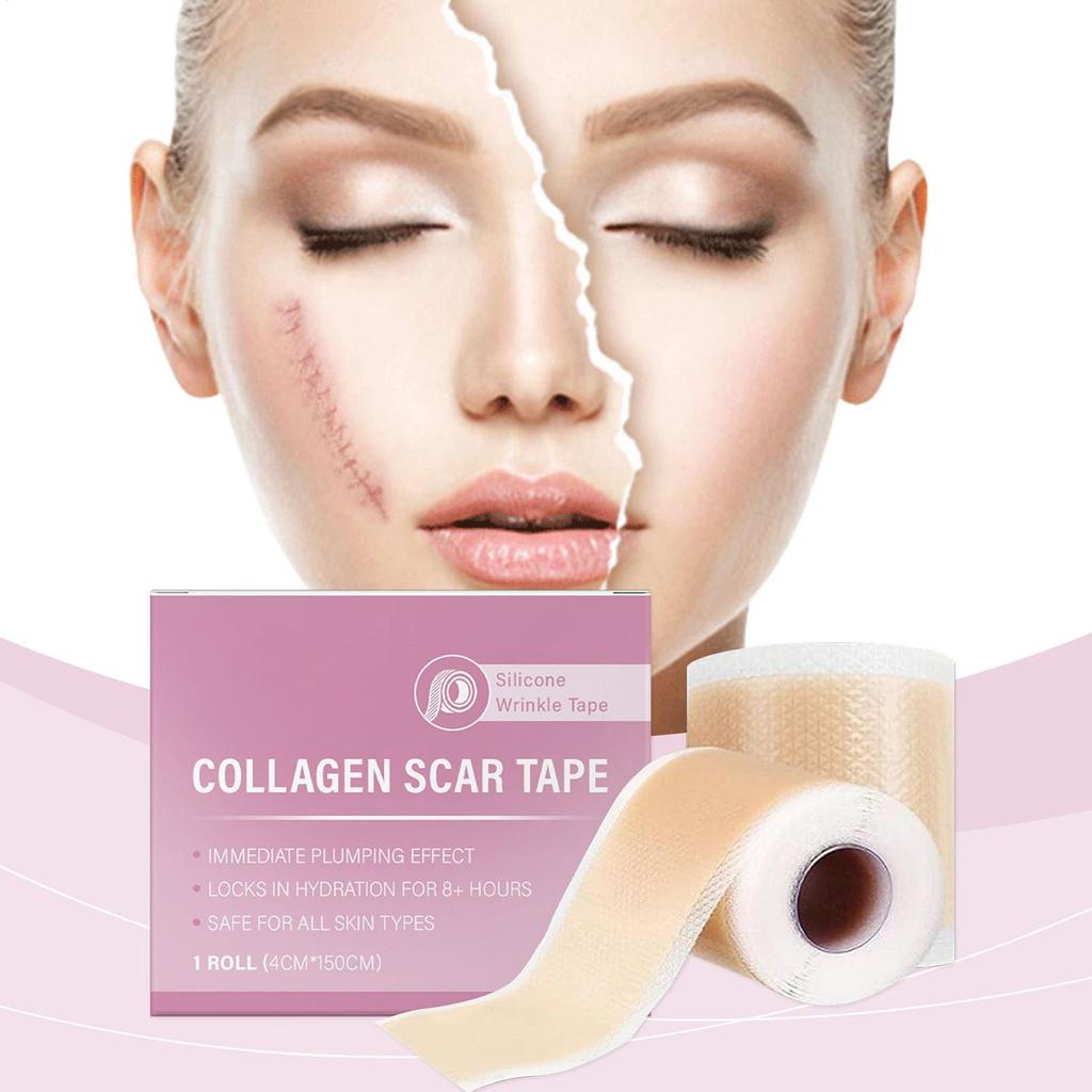Silicone Scar Patch 4x150cm Waterproof Keloid Removal Strip Effective Scar Therapy Self-Adhesive Tape for Surgical Acne Burn