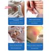 Disposable Ostomy Bags with Skin Stoma Rings Leakproof Barriers Baseplates Activated Carbon Sheet Lining for Safe Daily Use