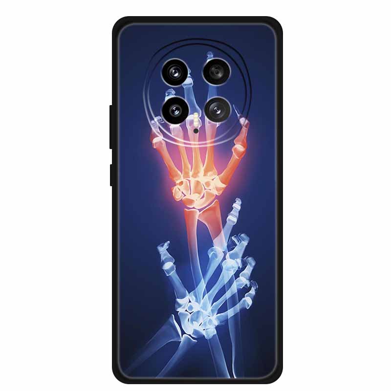 Mobile Phone Protective Case For Honor Magic8 5G Floral Painted Soft Black Silicone Back Cover For Honor Magic 8 2025 Case Funda